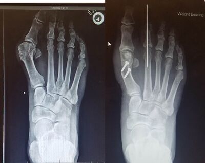 Foot2.jpg