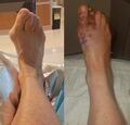 Foot1.jpg